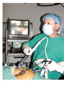 急性出血壞死型胰腺炎 急性出血壞死型胰腺炎