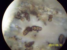 蔥鏈格孢，山東章丘繡惠大蔥紫斑病