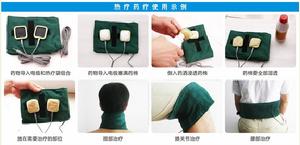 藥物離子導入療法