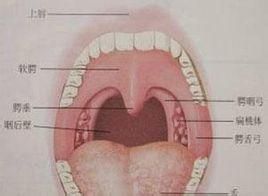 咽後壁膿腫 咽後壁膿腫