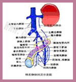 美國顯微精索搭橋術
