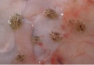 瘡痂魚虱屬 瘡痂魚虱屬