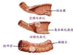 腸鳴音亢進 腸鳴音亢進