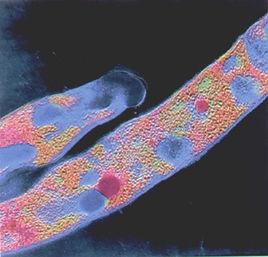 彎曲桿菌 彎曲桿菌