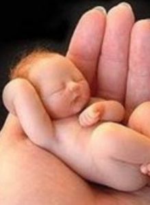 新生兒膽紅素腦病 新生兒膽紅素腦病