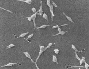 肺炎支原體 肺炎支原體