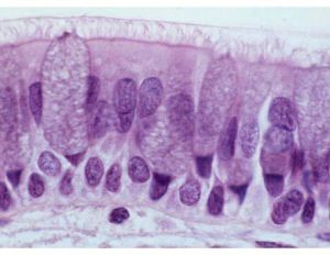 假復層柱狀纖毛上皮 假復層柱狀纖毛上皮
