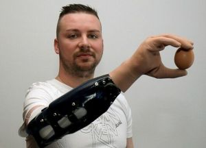 智慧型假肢 智慧型假肢