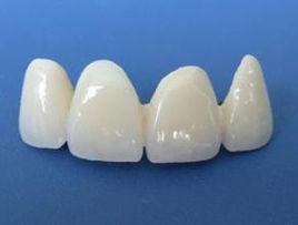陶瓷牙