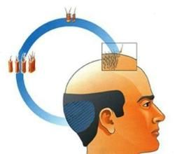 植髮手術 植髮手術