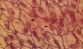 單層扁平上皮 單層扁平上皮