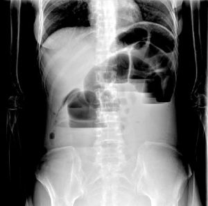 液氣平面 液氣平面