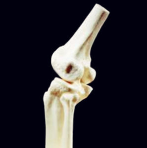 膝蓋骨刺 膝蓋骨刺