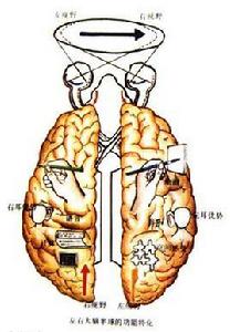 皮質核束 皮質核束