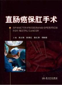 直腸癌保肛手術 直腸癌保肛手術