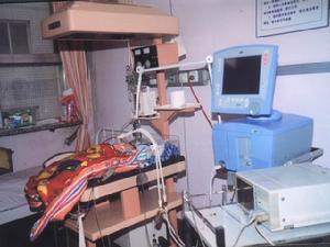 新生兒呼吸暫停