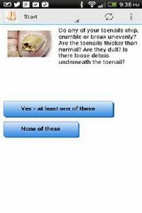 腳趾甲真菌測驗 腳趾甲真菌測驗