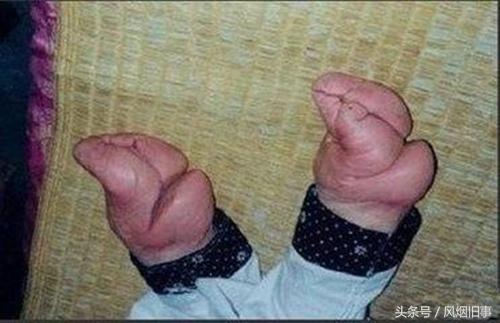 傳說中的三寸金蓮,令人心酸,更令人觸目驚心 傳說中的三寸金蓮,令人心酸,更令人觸目驚心