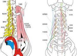前斜角肌肥厚痙攣