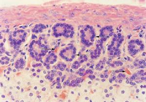 腎上腺皮質功能異常伴發的精神障礙