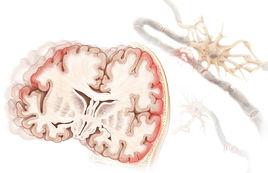 創傷性記憶 創傷性記憶