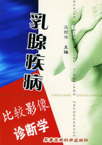 乳腺疾病比較影像診斷學 乳腺疾病比較影像診斷學