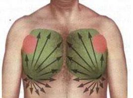 老年男性乳房無痛性腫塊 老年男性乳房無痛性腫塊