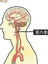 頸內動脈 頸內動脈
