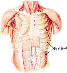 肋間神經痛 肋間神經痛