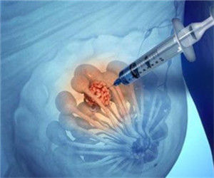 活組織檢查 活組織檢查