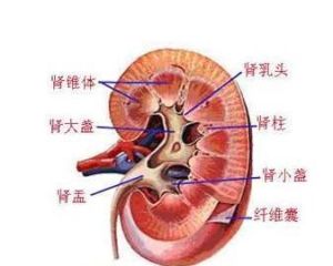 微小病變型腎病