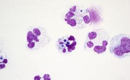 瑞氏染色法 瑞氏染色法