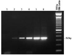 《PCR技術檢測細菌》