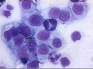 生物細胞三聯修復療法 生物細胞三聯修復療法