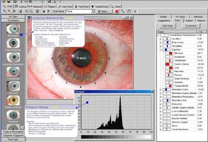 虹膜分析軟體