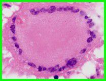 郎格罕細胞 郎格罕細胞