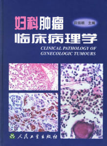 婦科腫瘤臨床病理學 婦科腫瘤臨床病理學