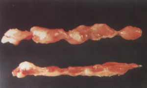 雞傳染性貧血 雞傳染性貧血