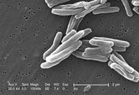電子顯微鏡下的結核桿菌