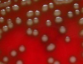 革蘭氏陽性菌 革蘭氏陽性菌