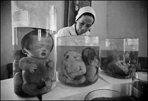 被落葉劑橙劑毒害的越南民眾