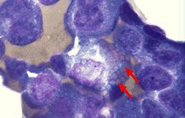 Rusell小體 Rusell小體