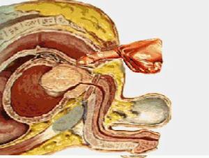 尿流動力學 尿流動力學