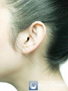 附耳整形 附耳整形