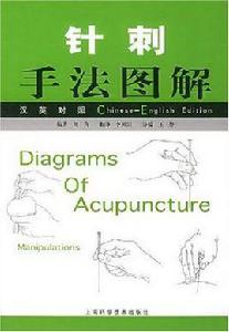 針刺手法圖解 針刺手法圖解