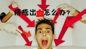 內痔出血 內痔出血