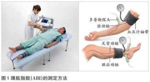 踝肱指數