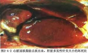 肝表面散布灰白色、針頭大的壞死點