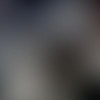 IC 1030 RASS 彩色圖