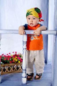 多巴反應性肌張力障礙